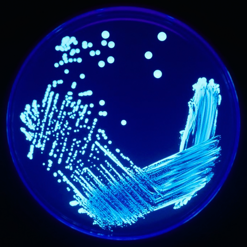 PPCL legionella PPCL legionella